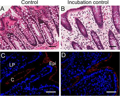 Blockade of Pannexin-1 Channels and Purinergic P2X7 Receptors Shows Protective Effects Against Cytokines-Induced Colitis of Human Colonic Mucosa